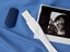 Ultrassonografia obstétrica 4D/3D: Aplicações e vantagens na visualização fetal